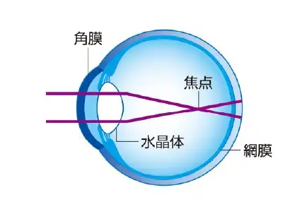 つける前…近視の状態