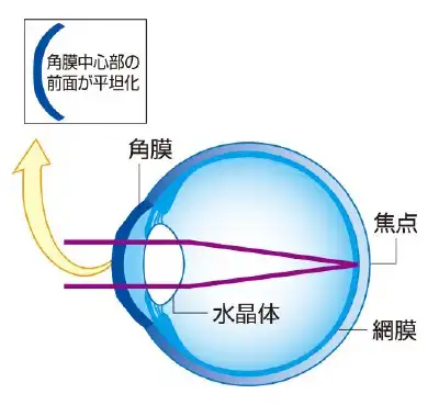 はずした後