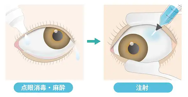 点眼消毒・麻酔 / 注射